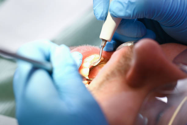 Best Emergency Dental Surgery in Caddo, OK